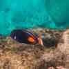 achilles tang